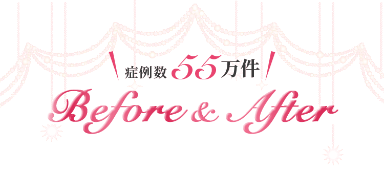 症例数20万件 Before After 確かな技術で歪みを正常な状態に導きます