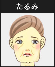 たるみ