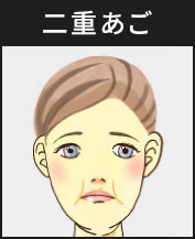 二重あご